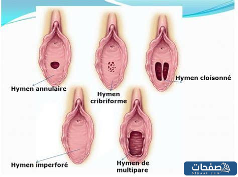 كيف اعرف اني عذراء؟