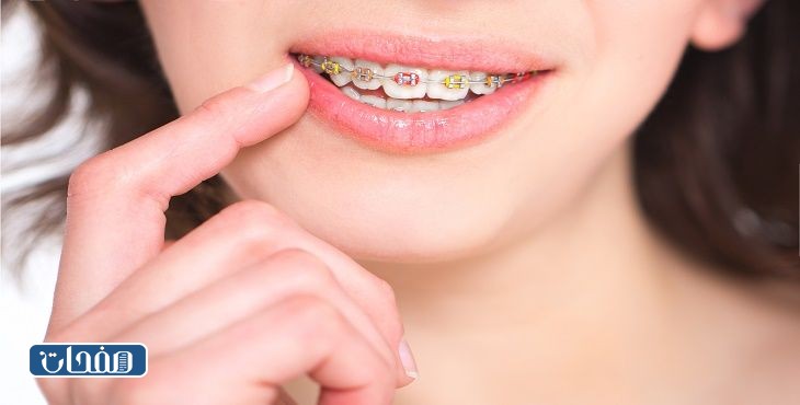 أفضل دكتور تقويم أسنان في جدة