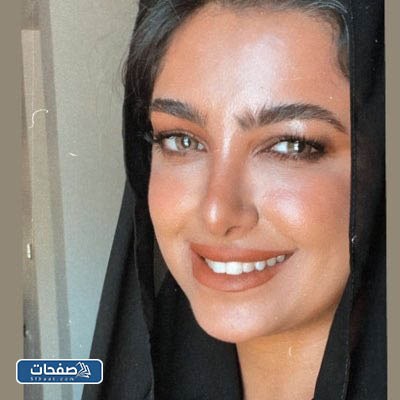 أنف نجلاء الودعاني بعد التجميل