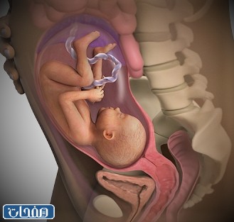 ارتفاع حرارة الجسم للحامل