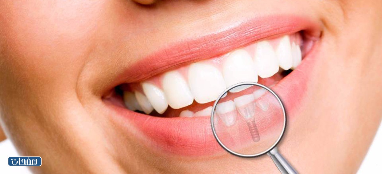 افضل دكتور تركيبات اسنان في جدة