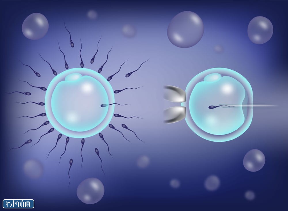 انتفاخ البطن عند الحامل