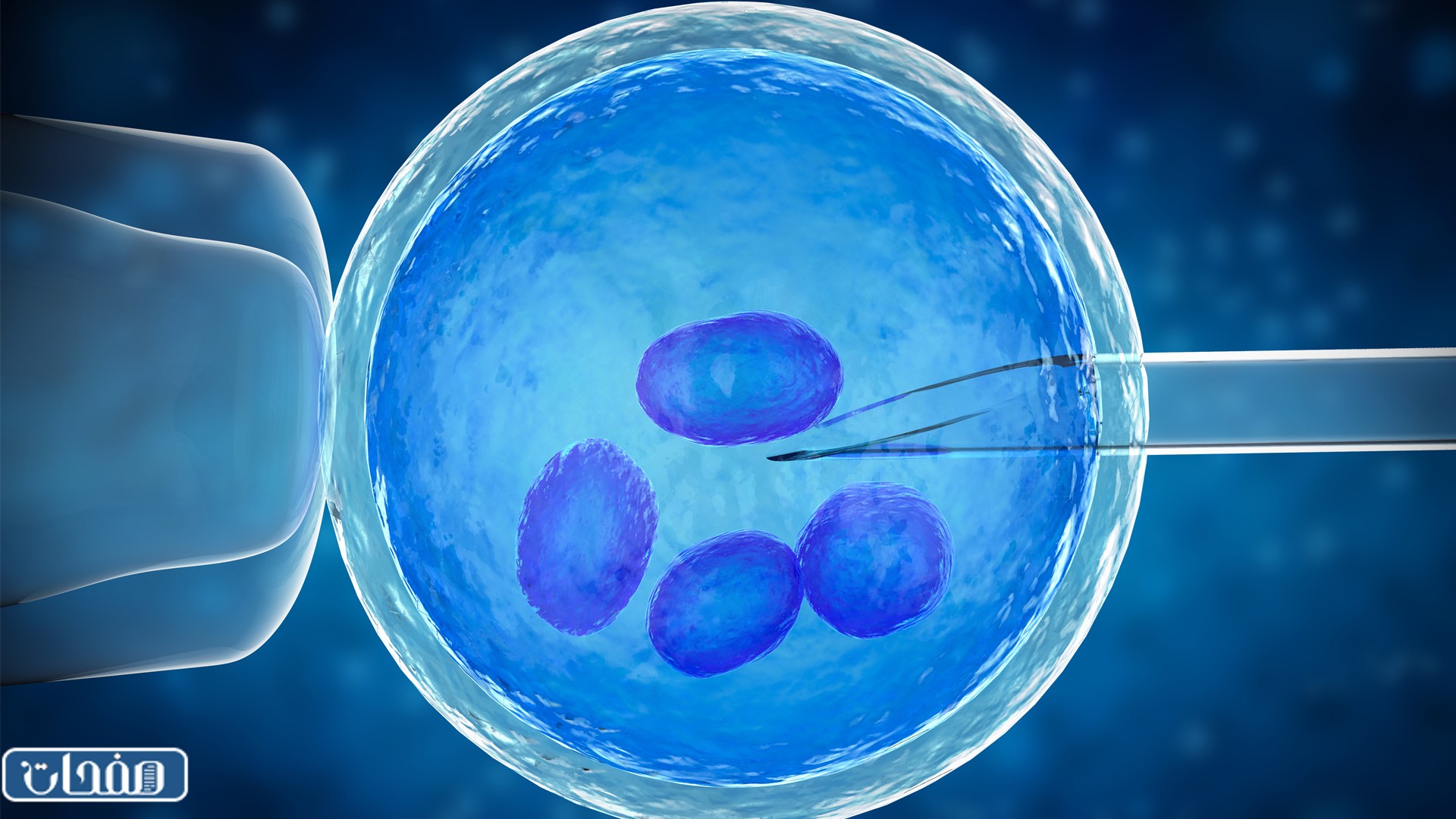 تقلصات الحوض من علامات الحمل