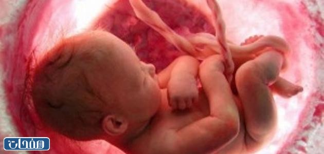 تشنجات الحمل