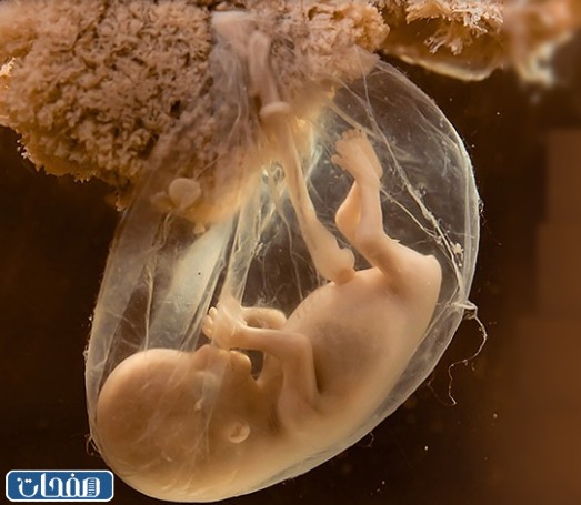 التقلبات المزاجية الكثيرة في الحمل