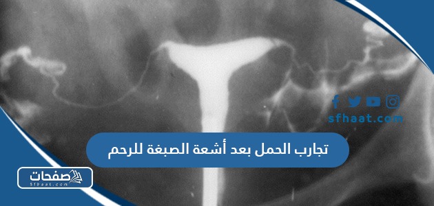 تجارب الحمل بعد أشعة الصبغة للرحم