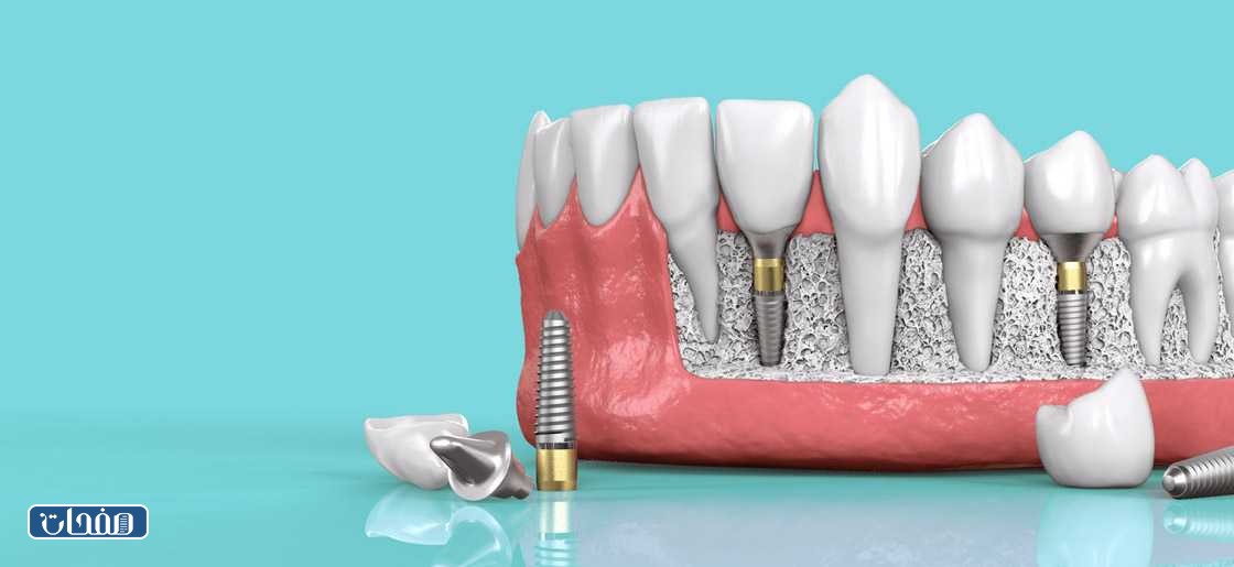 دكتورة ديمة نور الدين