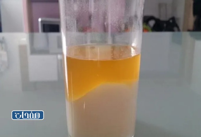 طريقة إجراء اختبار الحمل بالملح