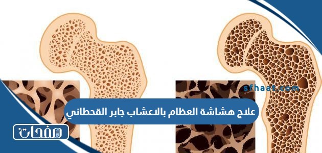 علاج هشاشة العظام بالاعشاب جابر القحطاني