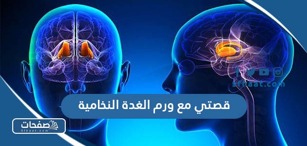 قصتي مع ورم الغدة النخامية