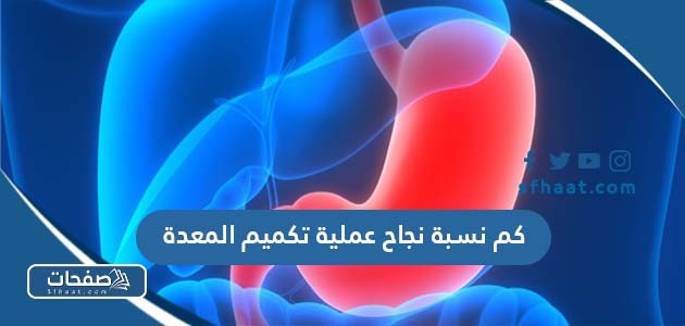 كم نسبة نجاح عملية تكميم المعدة