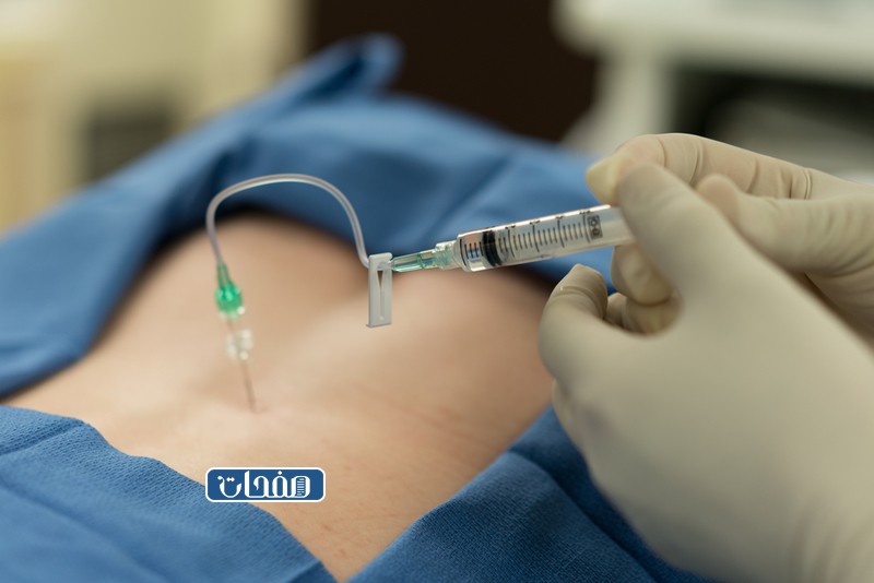 مين جربت البنج النصفي في القيصري