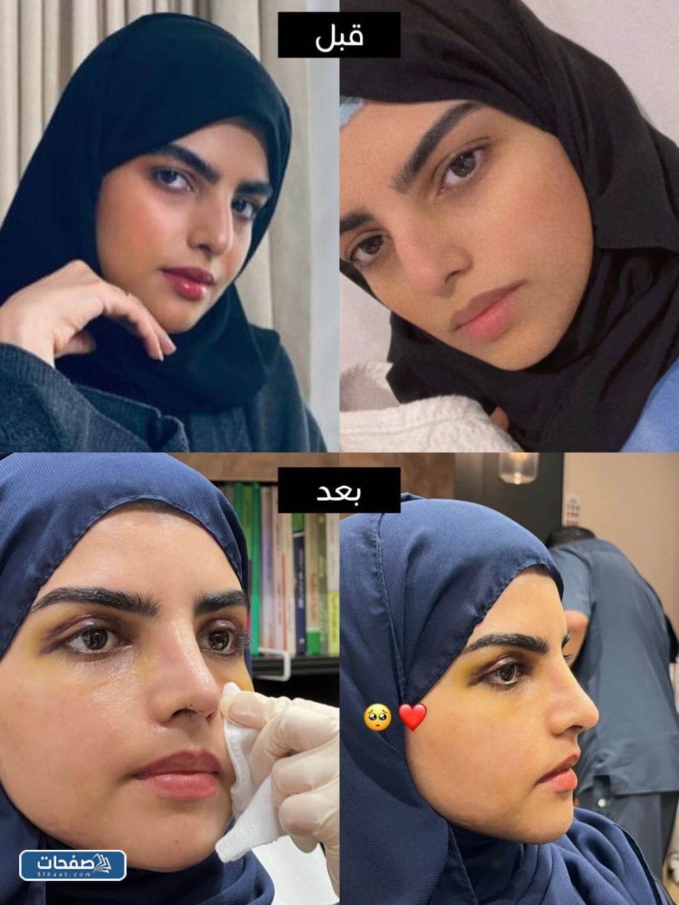 نجلاء الودعاني قبل وبعد