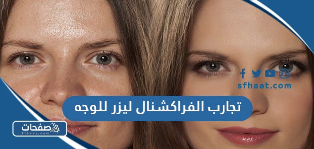 تجارب الفراكشنال ليزر للوجه
