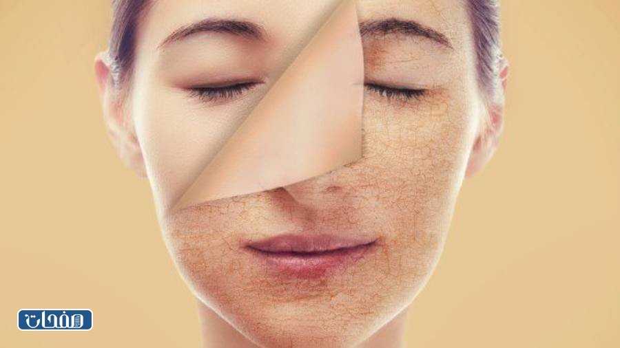 تجارب الفراكشنال ليزر للوجه