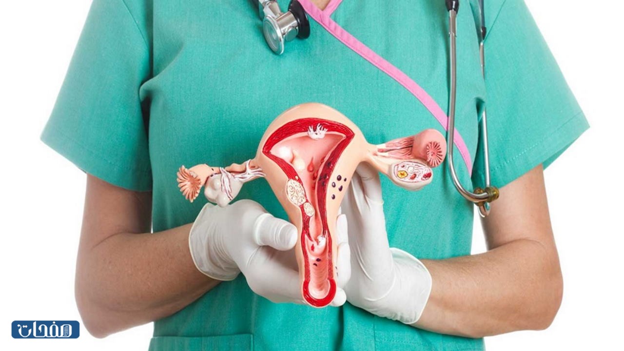 تجارب النساء بعد استئصال الرحم