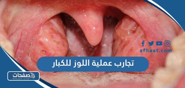 تجارب عملية اللوز للكبار