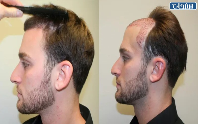 التجربة الثانية