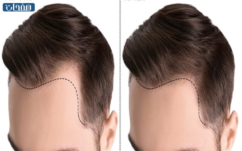 التجربة الأولى