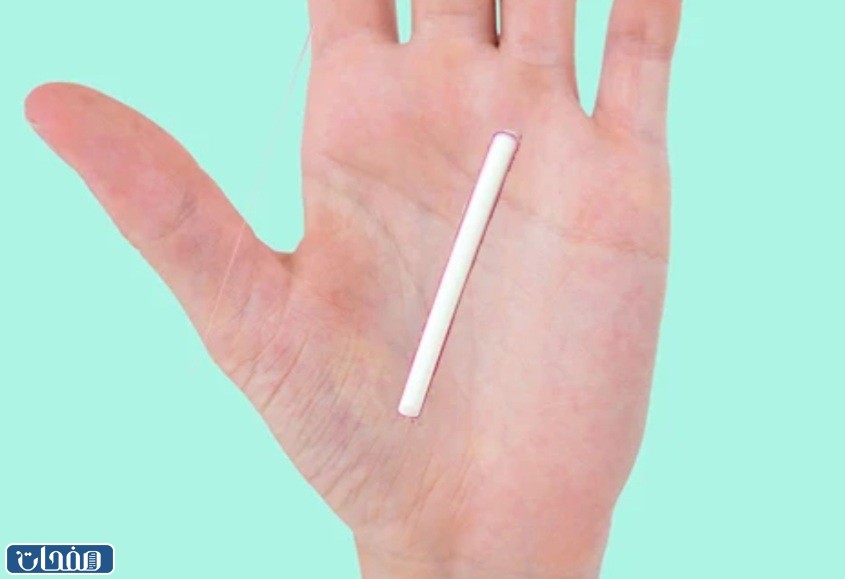 تجارب أحد يركب شريحة منع الحمل