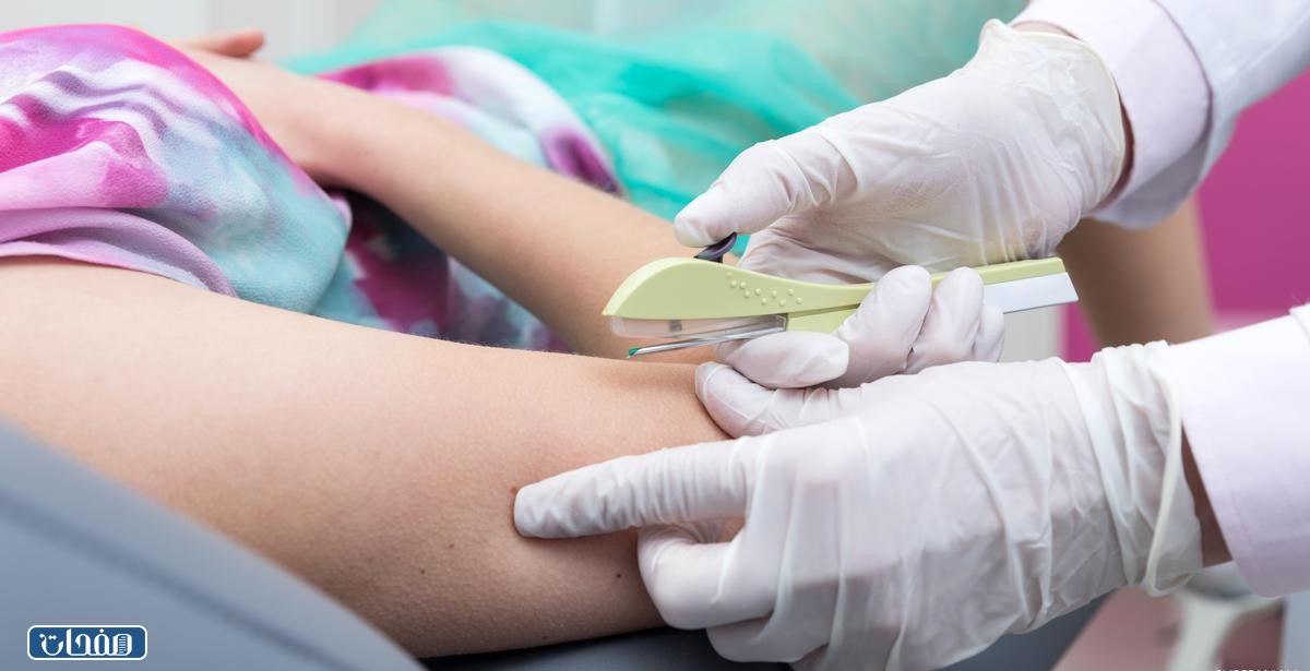 كم سعر شريحة منع الحمل