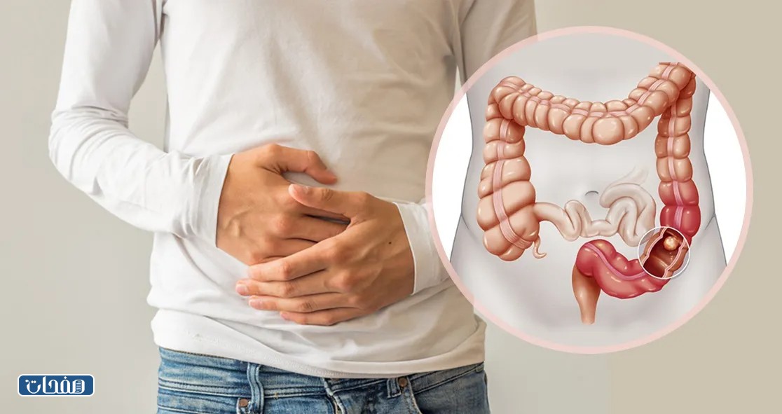 كم سعر منظار القولون في السعودية